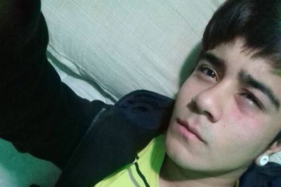 Atacaron a un joven en Berazategui por ser gay: "Estas cosas siguen pasando y no están superadas", dijo