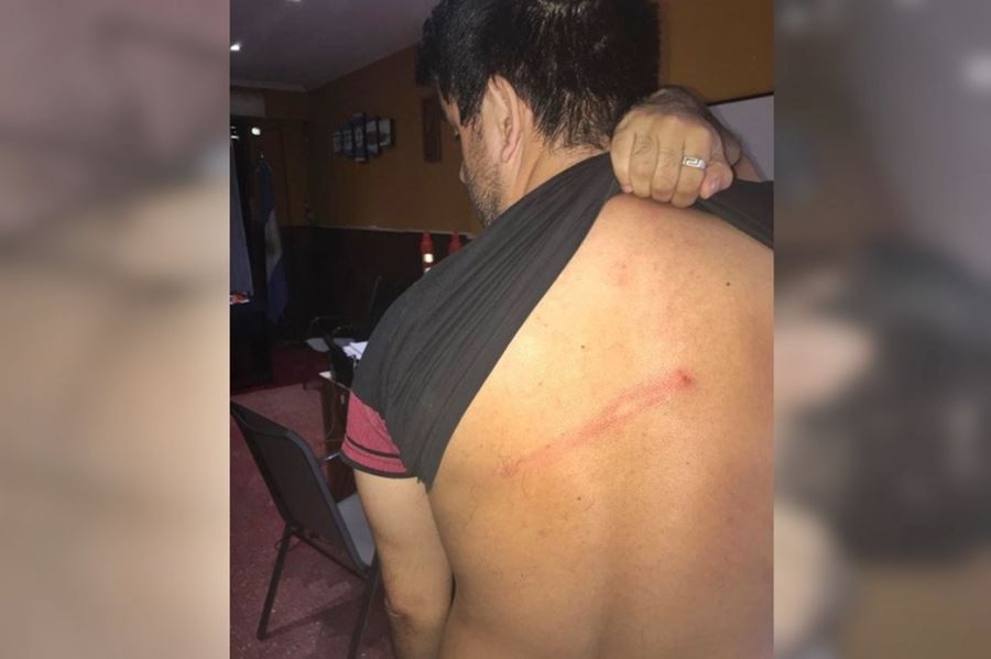 Diputados bonaerenses repudiaron la agresión que sufrió el concejal de La Matanza mientras realizaba un timbreo