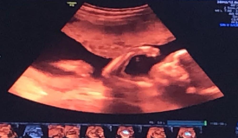 “Será una niña”: la alegría del intendente tuitero que pronto será papá