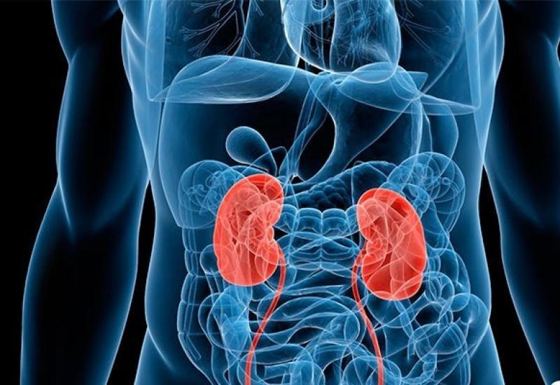 Hablemos de cáncer renal: los síntomas de una enfermedad que crece