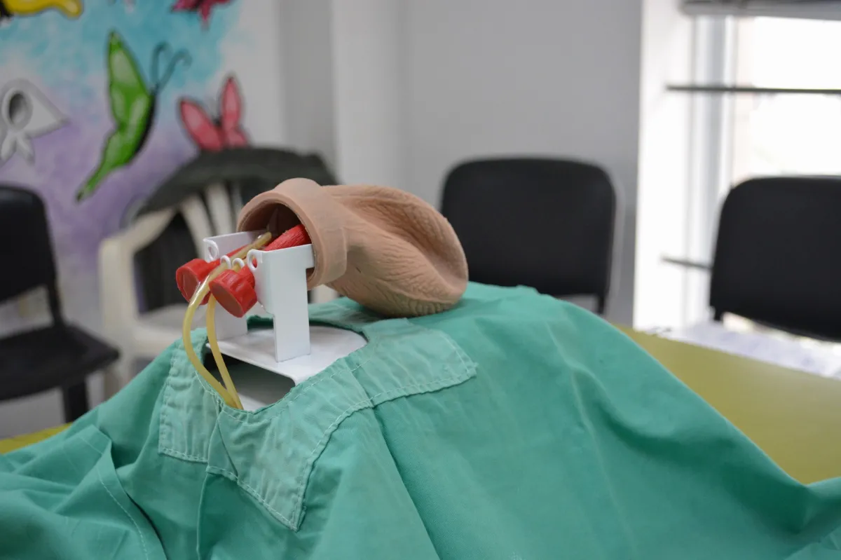 La vasectomía sin bisturí gana terreno en hospitales públicos bonaerenses